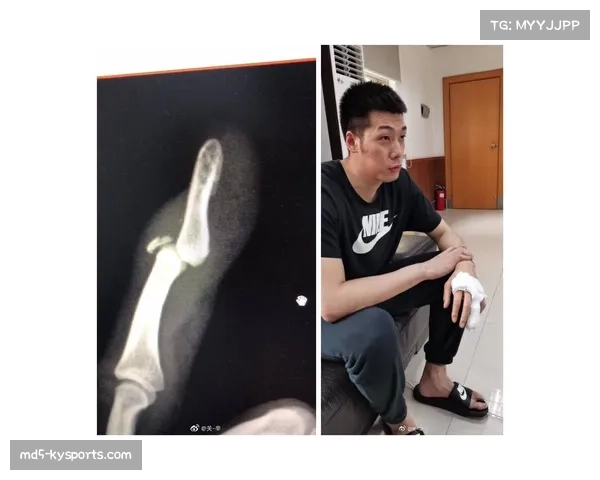 手部接触禁止改变防守方式 现代规则更保护进攻球员